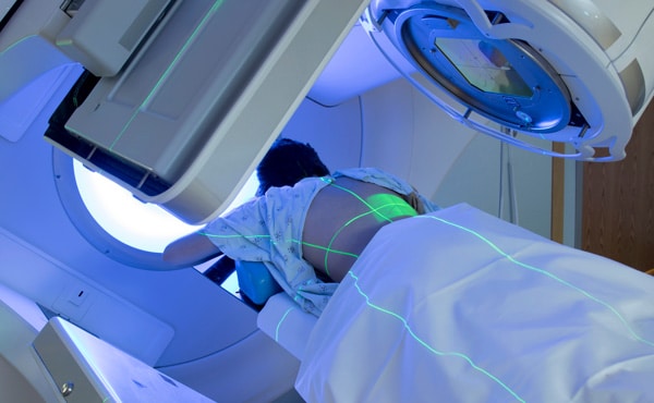 radiation therapy