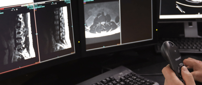 viewing MRIs